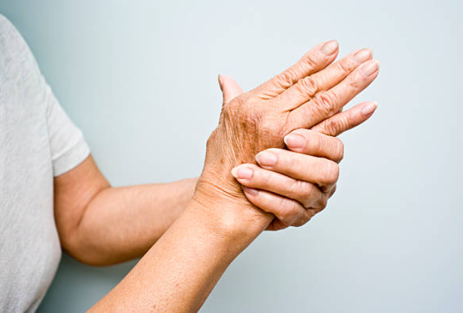 Rheumatoid arthritis: What is it and what can you do about it